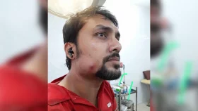 তেজগাঁওয়ে প্রাইভেট কারে এলোপাতাড়ি গুলি, পথচারী গুলিবিদ্ধ