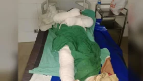 চাঁদপুরে সুদের টাকা না পেয়ে গৃহবধূকে পুড়িয়ে হত্যাচেষ্টার অভিযোগ